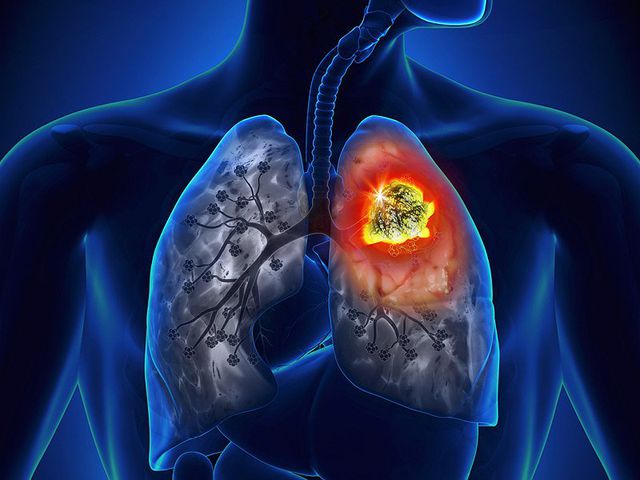 Phát hiện mới: Ớt giúp làm chậm quá trình di căn của ung thư phổi - 1